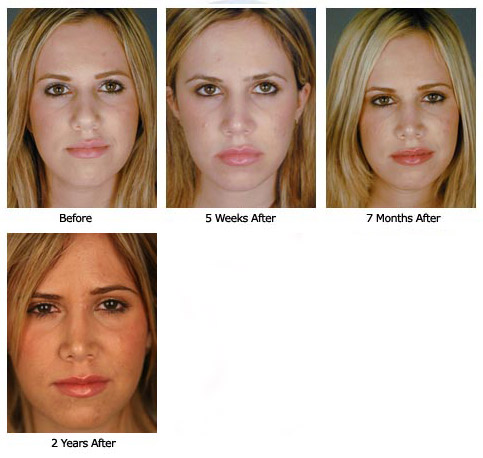 Patient 61 rhino$60a new Patient 61