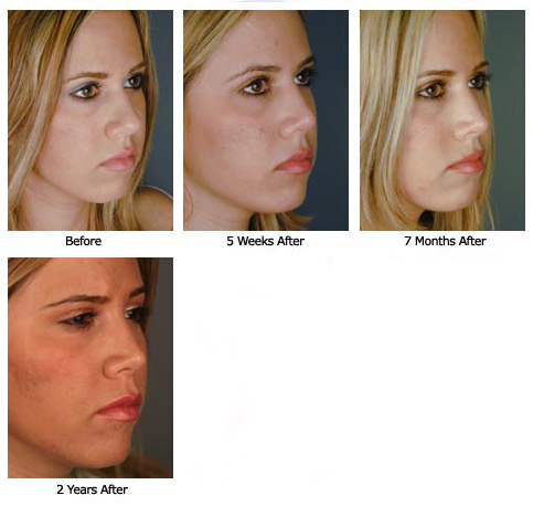 Patient 61 rhino$60c new Patient 61