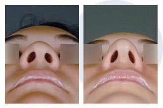 Patient 63 rhino$63e Patient 63