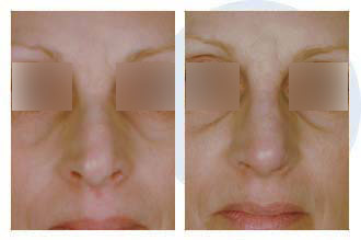 Patient 67 rhino$67d Patient 67