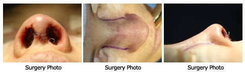 Patient 119 rhino$119h2 Patient 119