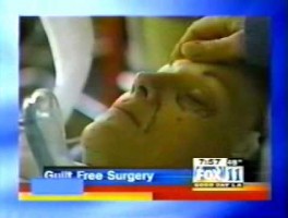 Beverly Hills Plastic Surgery News | Guilt-Free Facelift