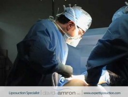 Anterior Thighs Liposuction Surgery Thigh Lipo Surgeon Dr. David Amron