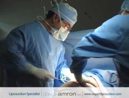 Butt Liposuction Surgery Buttocks Lipo Surgeon Dr. David Amron