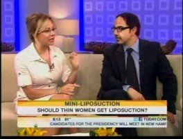 Dr. Amron Featured on the Today Show Discussing Mini-Liposuction