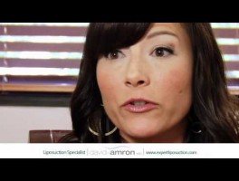 Los Angeles Liposuction Surgeon Review & Testimonial about Cosmetic Surgeon Dr. Amron