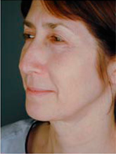 Before patient Photo 2