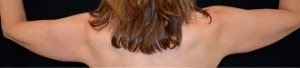 Before patient Photo
