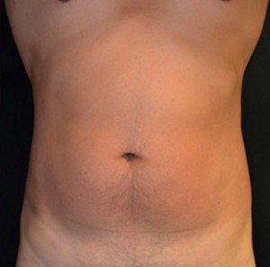 Before patient Photo